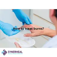 How to treat burns? - 1