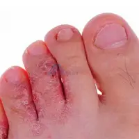 Why take care of your feet?