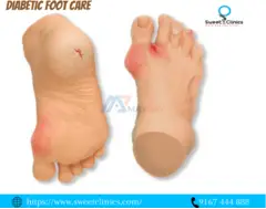 Diabetes foot treatment in Navi Mumbai - 1