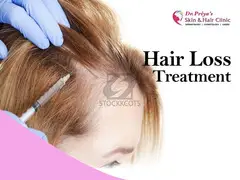 Best Hair Loss Treatment in Marathahalli, Bangalore