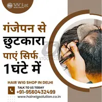 Hair Wig Shop in Delhi - Get rid of baldness in just 1 hour