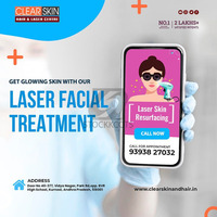 Laser treatment clinic in india - 1